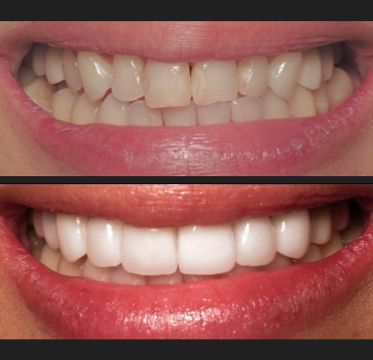 smilemakeover2
