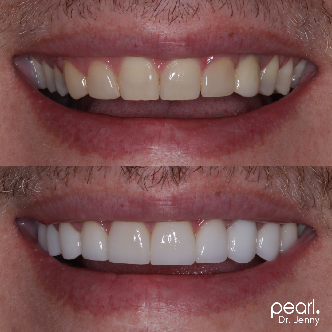 Unleash Your PRIDE with Cosmetic Dentistry! Uptown Charlotte Dentist