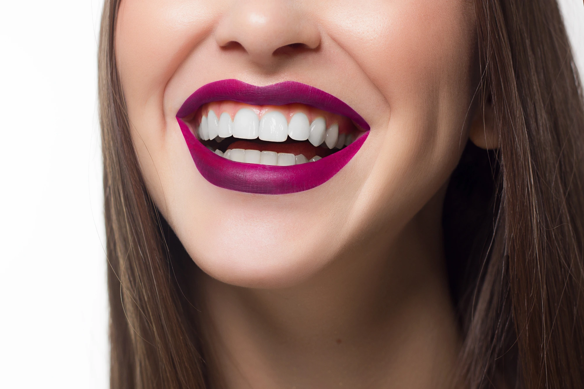 close up of great smile after teeth whitening in South End Charlotte