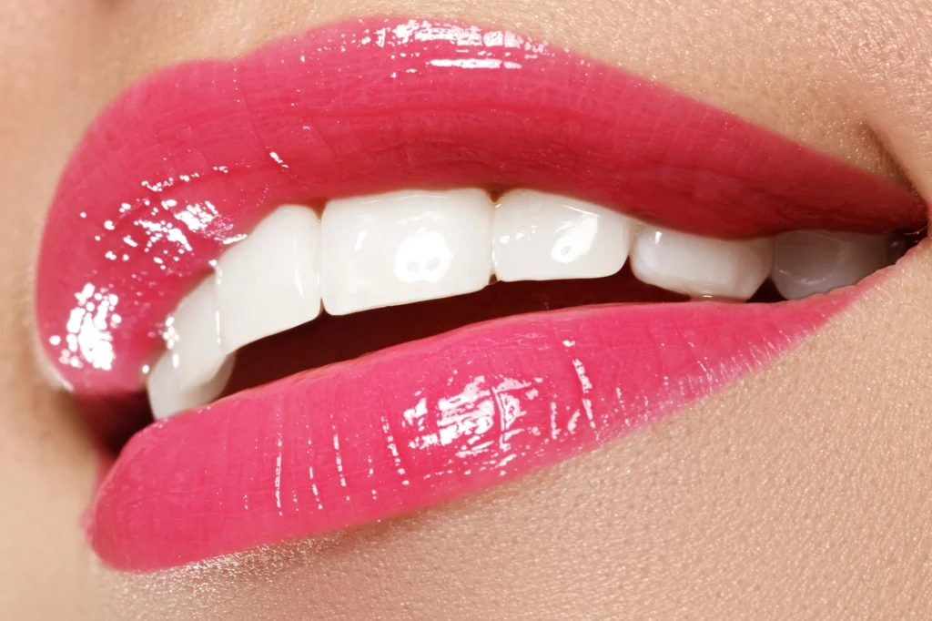 close up of perfect smile after using Invisalign in Dilworth, NC