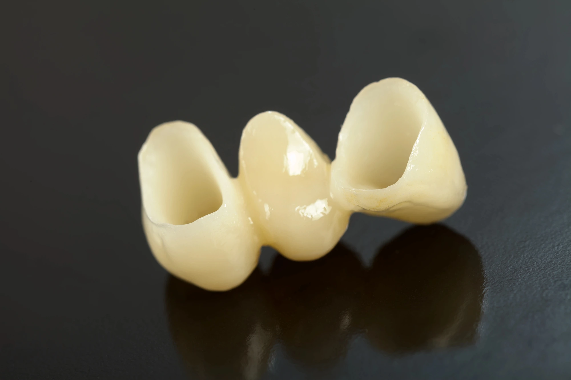 dental bridges in Charlotte, NC on table
