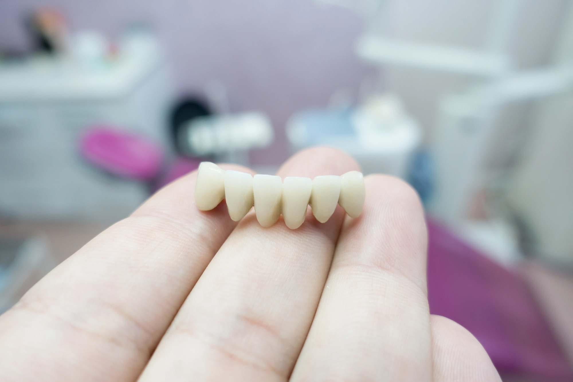 dentist showing dental bridges in Charlotte