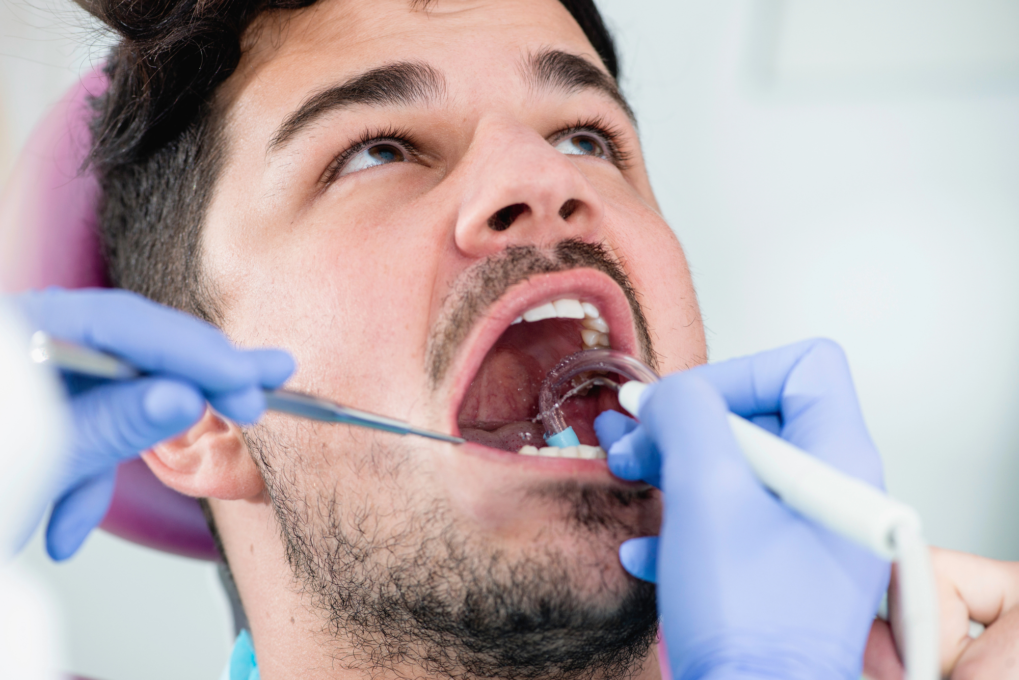 man opening mouth to receive tooth-colored fillings near me