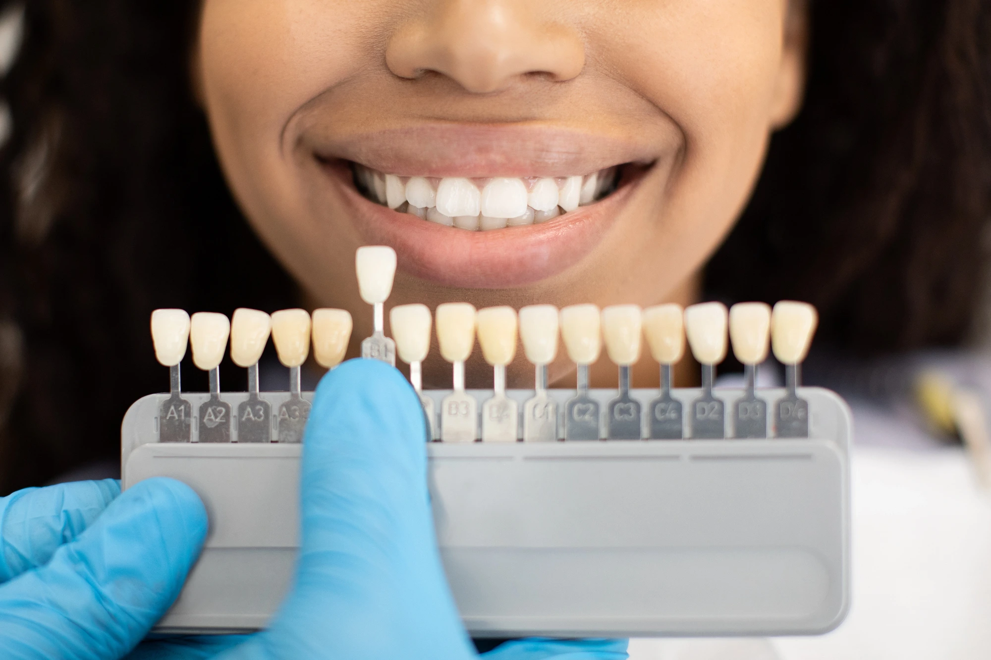 patient getting cosmetic dentistry in Uptown Charlotte (1)