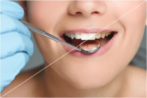 professional teeth whitening in South Charlotte