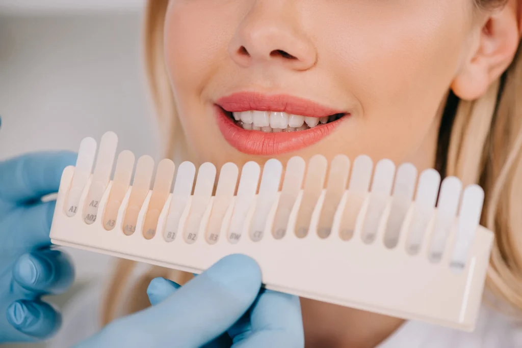 woman deciding teeth color for teeth whitening in Uptown Charlotte
